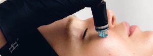 hydrafacial treatment